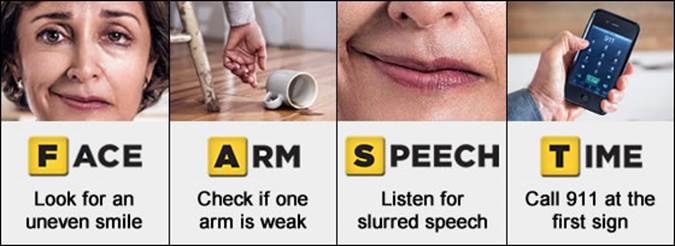 FAST signs of stroke